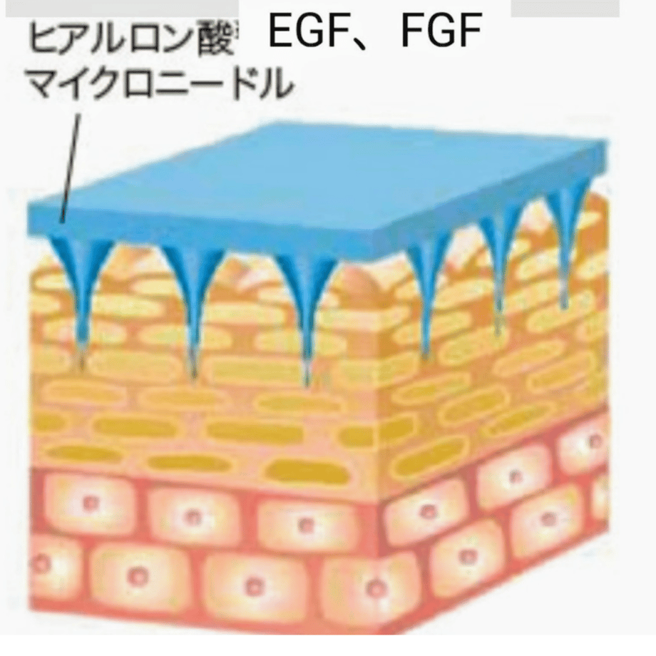 60389957c19c455cbcbf2d23