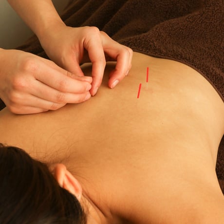 Let's go to the acupuncture & aromatherapy massage at Tensinotamago!