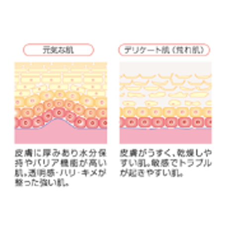 ポリシー　アピールローション（化粧水）　100ml