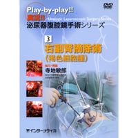 DVD『実況!! 泌尿器腹腔鏡手術シリーズ　3. 右副腎摘除術［褐色細胞腫］ （70分）』
