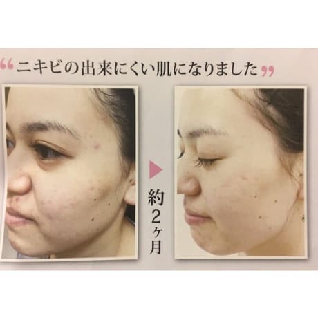 ホワイティー パラオパック　90g　（リセラ）
