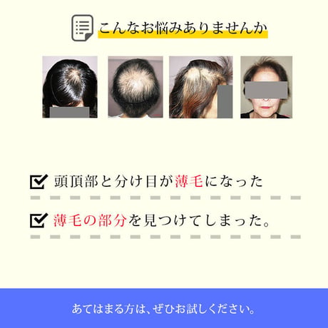 【新発売記念20％OFF】ラヴィエルジュ 薬用育毛エッセンス (医薬部外品〉