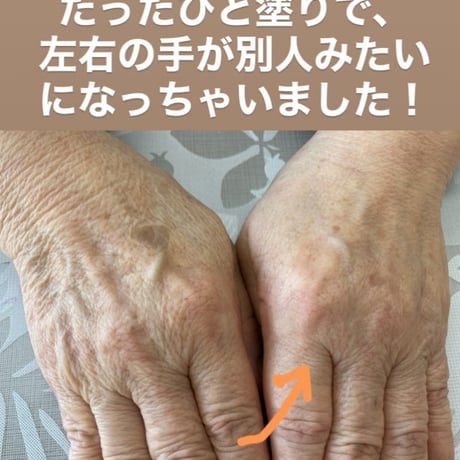 ルミエールクリーム｜業界最高水準のマイナスイオン放出 スーパーオールインワンホルミシスクリーム