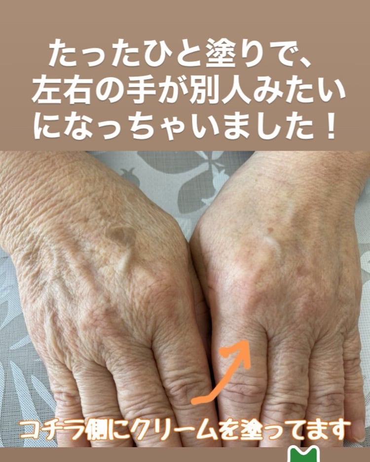 ルミエールクリーム｜業界最高水準のマイナスイオン放出 スーパー