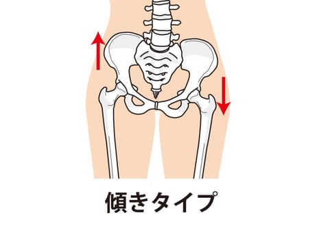 【骨盤矯正エネルギー】