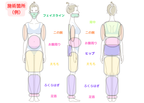 【脂肪吸引エネルギー】
