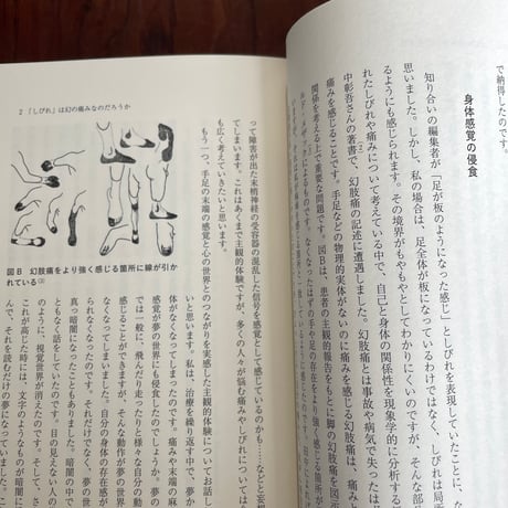 ままならぬ顔・もどかしい身体　痛みと向き合う13話