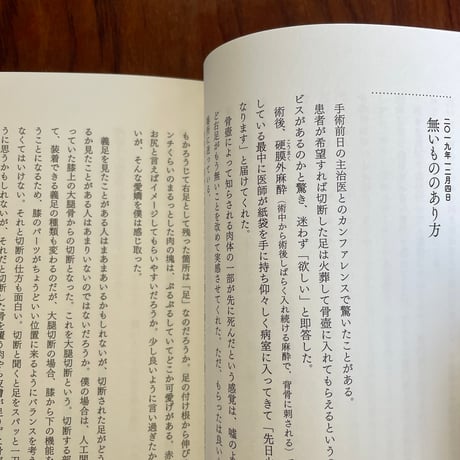 幻肢痛日記　無くなった右足と不確かさを生きる