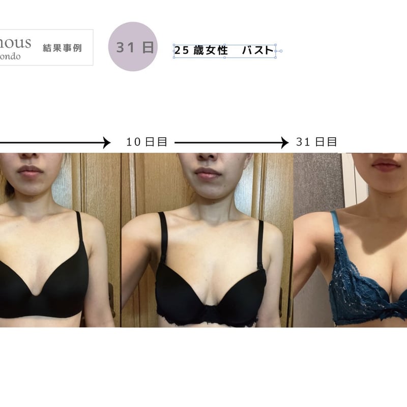 2ヶ月 定期便 10%オフ】[セインムー・ボーテロンド 30mL] 部分太り