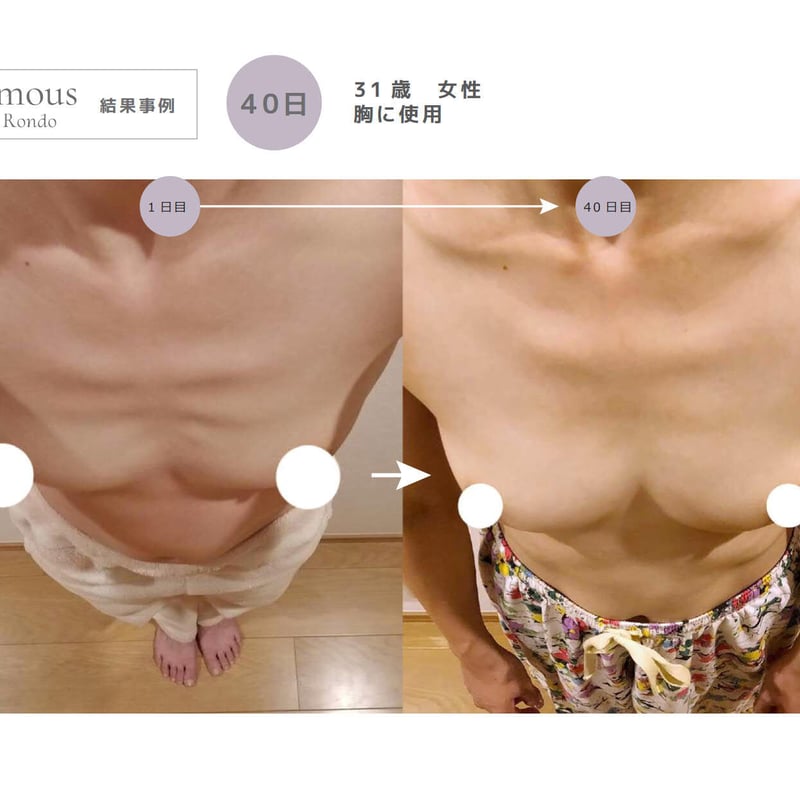 セインムー・ボーテロンド 100mL] 部分太り®美容液-顔・首のシワ改善