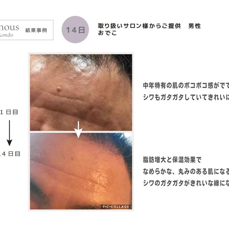 抹茶【新品未開封】セインムー ボーテロンド30ml 1ヶ月 定期便 15%オフ