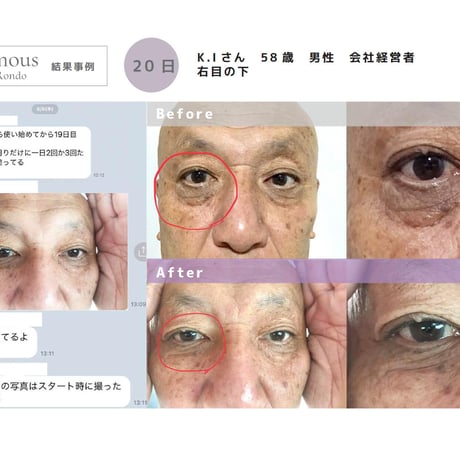 [セインムー・ボーテロンド 30mL]  部分太り®美容液-顔・首のシワ改善/バストケア