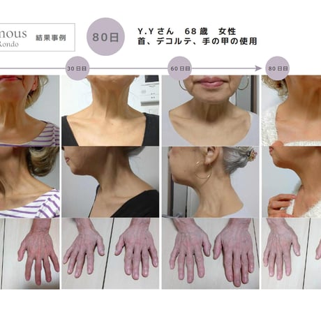 [セインムー・ボーテロンド 100mL]  部分太り®美容液-顔・首のシワ改善/バストケア