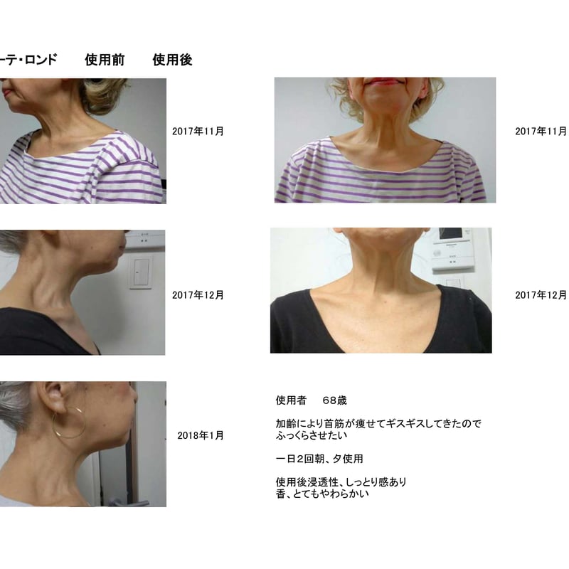 セインムー・ボーテロンド 30mL] 部分太り®美容液-顔・首のシワ改善