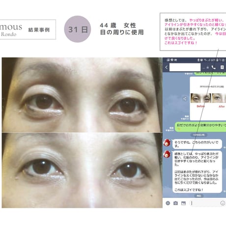 [セインムー・ボーテロンド 30mL]  部分太り®美容液-顔・首のシワ改善/バストケア