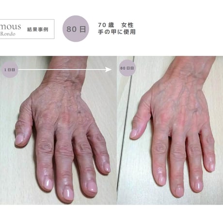 [セインムー・ボーテロンド 30mL]  部分太り®美容液-顔・首のシワ改善/バストケア