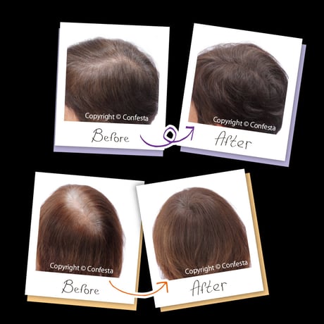 簡単白髪・薄毛カバーMycoヘアファンデーション
