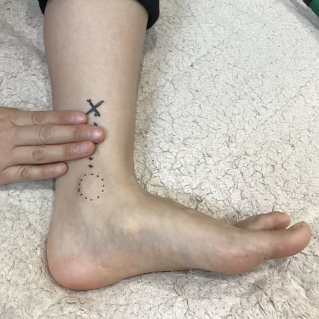 火を使わない温灸（妊活お灸セルフケア指導付）