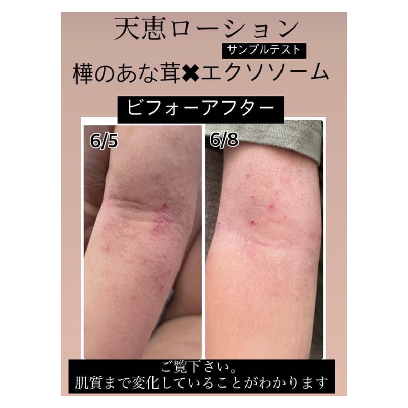 【新品未使用】天恵ローション Amazon | テンケイローション 天恵ローション 100ml 天恵化粧水