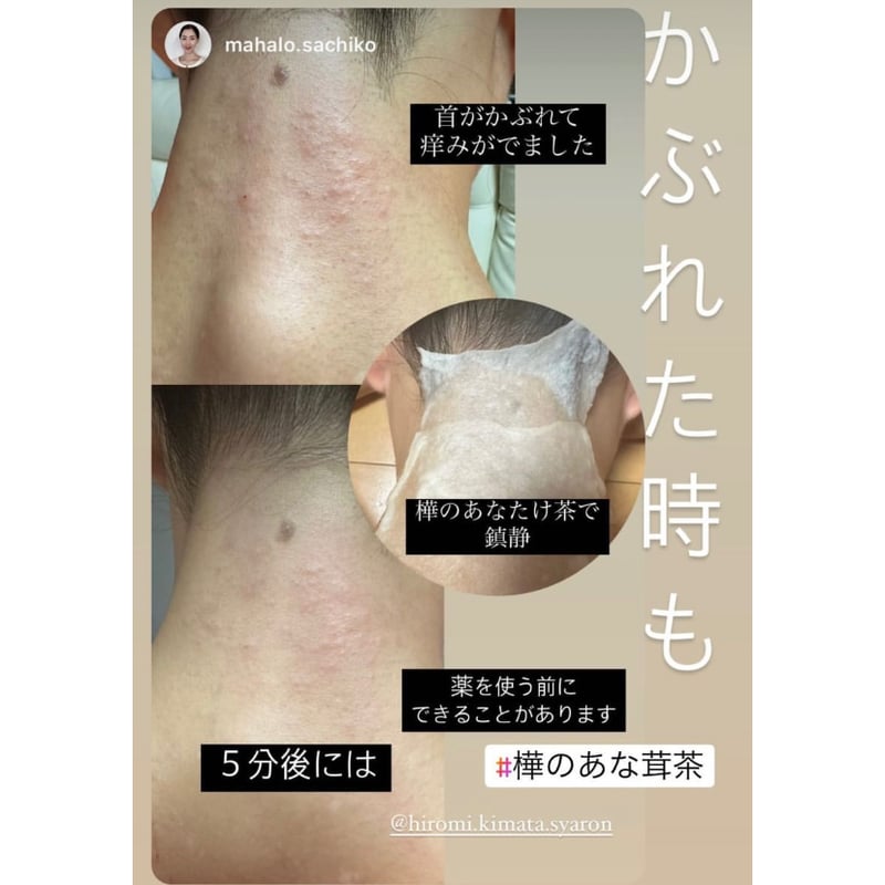 天恵ローション Amazon | プラスケア 天恵クオリティソープ (天恵ローション1個