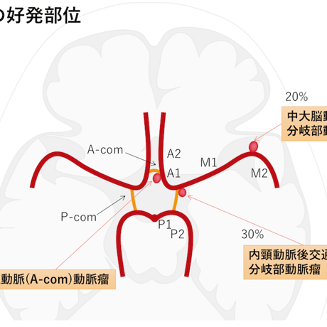 ESPRESSO頭部救急画像診断【本編】