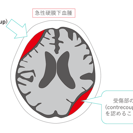 ESPRESSO頭部救急画像診断【本編】