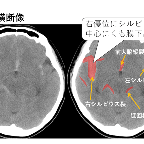 ESPRESSO頭部救急画像診断【本編】