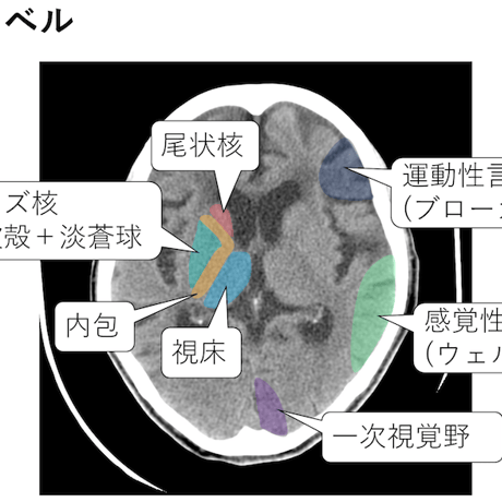 ESPRESSO頭部救急画像診断【本編】