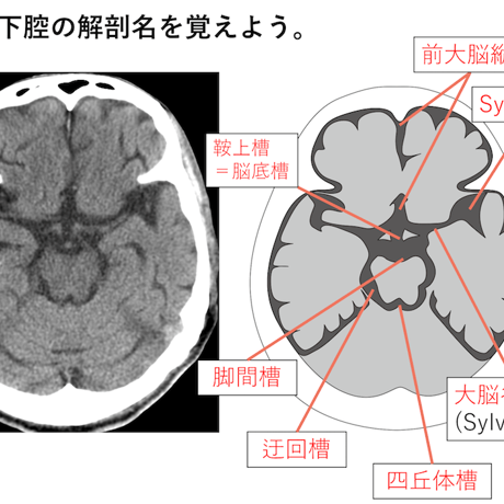 ESPRESSO頭部救急画像診断【本編】