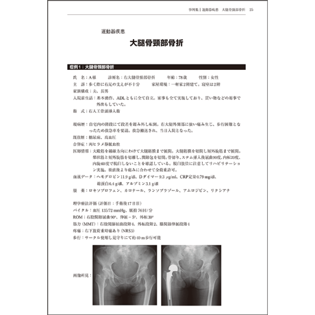 卒前・卒後教育に使える　理学療法のためのOSCEハンドブック