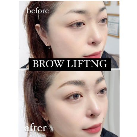 次世代眉セミナー　BROW LIFTING