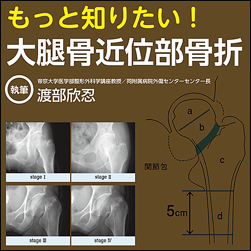 もっと知りたい！大腿骨近位部骨折 | 日本医事新報社 Webコンテンツ