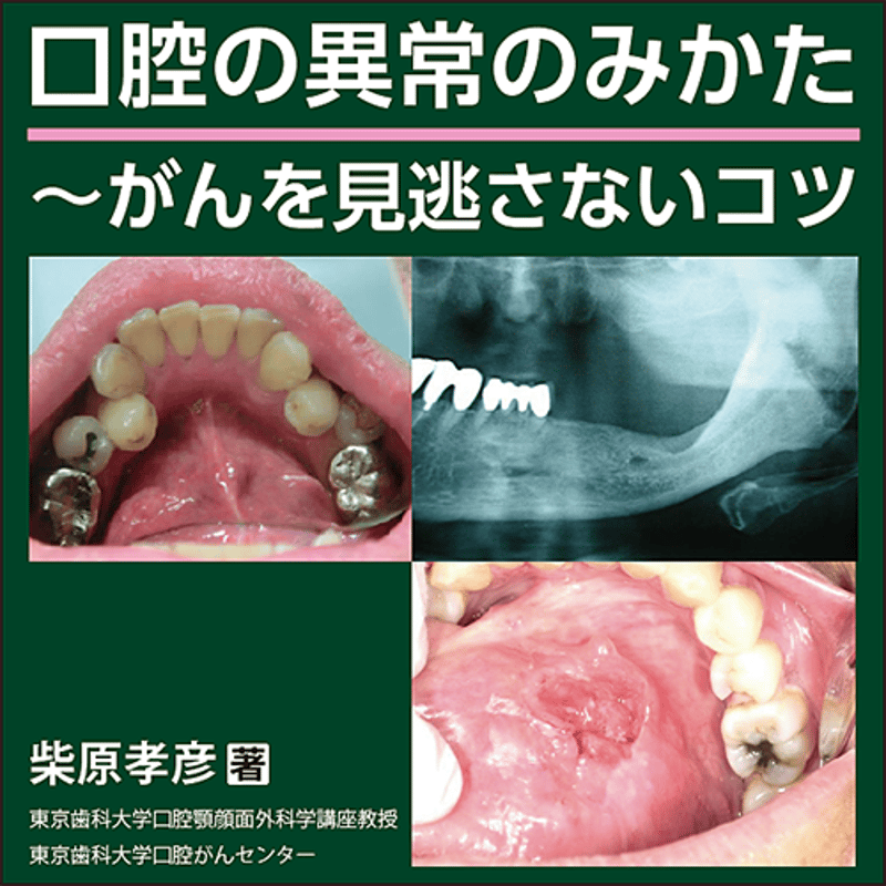 口腔の異常のみかた〜がんを見逃さないコツ | 日本医事新報社