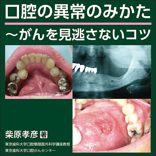 口腔の異常のみかた〜がんを見逃さないコツ | 日本医事新報社