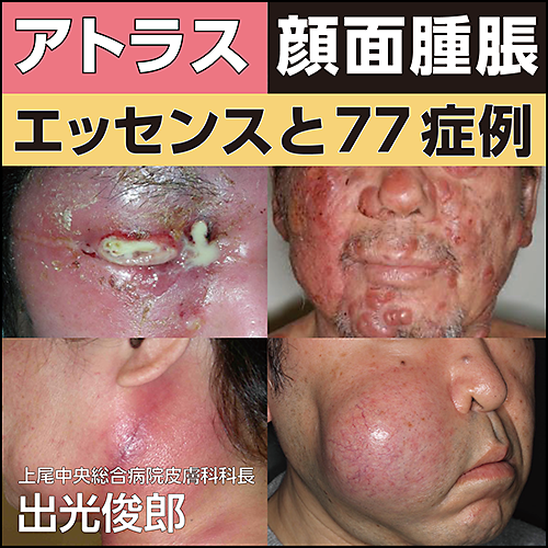 アトラス 顔面腫脹〜エッセンスと77症例 | 日本医事新報社 Web アトラス 顔面腫脹〜エッセンスと77症例 | 日本医事新報社 Web