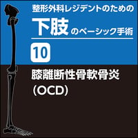 整形外科レジデントのための下肢のベーシック手術10　膝離断性骨軟骨炎（OCD）（PDF版）
