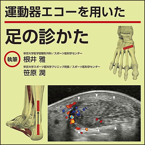 運動器エコーを用いた 足の診かた | 日本医事新報社 Web 運動器エコーを用いた 足の診かた | 日本医事新報社 Web