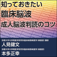知っておきたい臨床脳波〜成人脳波判読のコツ