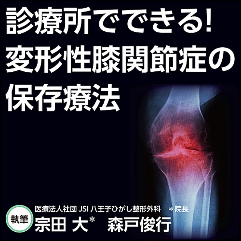 診療所でできる！変形性膝関節症の保存療法 | 日本医事新報社 Web
