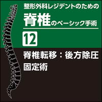 整形外科レジデントのための脊椎のベーシック手術12　脊椎転移：後方除圧固定術（PDF版）