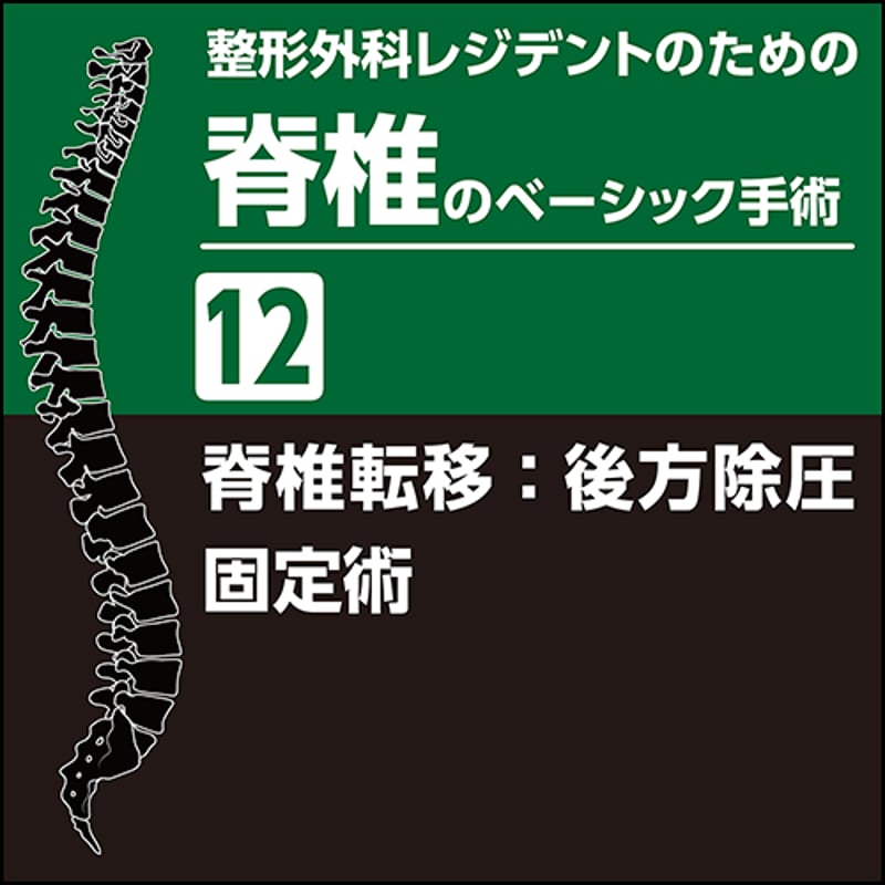 整形外科レジデントのための脊椎のベーシック手術12 脊椎転移：後方除
