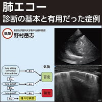 肺エコー〜診断の基本と有用だった症例