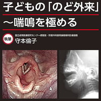 子どもの「のど外来」〜喘鳴を極める
