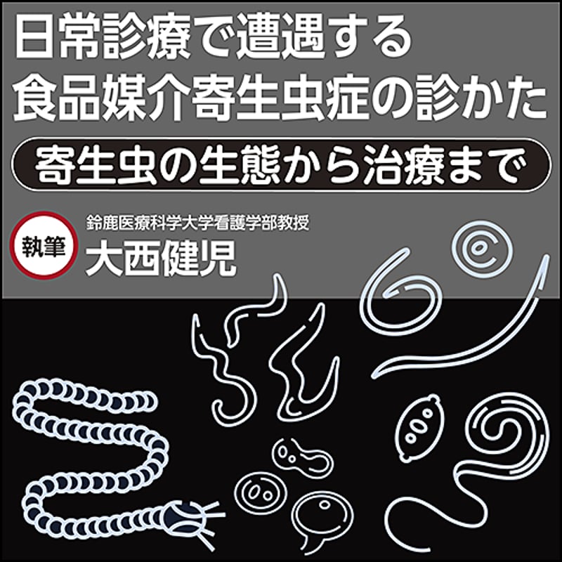 日常診療で遭遇する食品媒介寄生虫症の診かた〜寄生虫の生態から治療