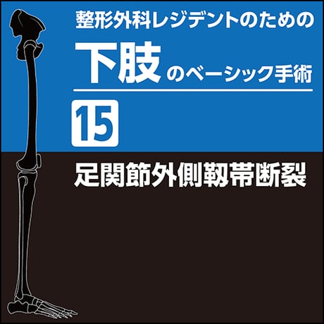 整形外科レジデントのための下肢のベーシック手術15　足関節外側靱帯断裂（PDF版）