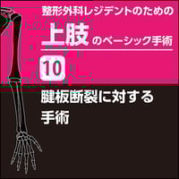 整形外科レジデントのための上肢のベーシック手術10　腱板断裂に対する手術（PDF版）
