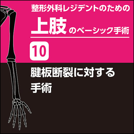 整形外科レジデントのための上肢のベーシック手術10　腱板断裂に対する手術（PDF版）