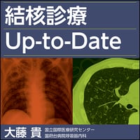 結核診療Up-to-Date