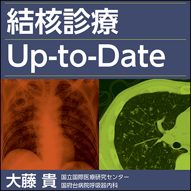 結核診療Up-to-Date | 日本医事新報社 Webコンテンツ販売サイト