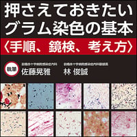 押さえておきたいグラム染色の基本～手順，鏡検，考え方